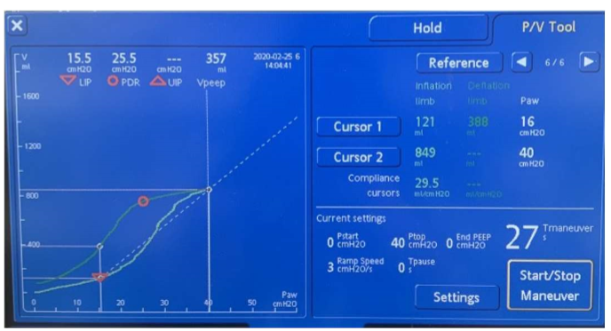 P at LIP (16 in pic)

e.g. Pstart = 0, EndPEEP = 16
