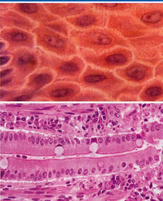 <p>Function: lines body cavities and outer surfaces of body, protects organs, keeps organs in place, forms glands that produce hormones/enzymes/sweat.</p><p></p><p>Skin epithelia: Thin, flat cells that form sheets and act as a semi-permeable barrier between the inside and outside of the body.</p><p>Columnar Epithelia: Made of columns of cells that line the small intestine, stomach, and glands.</p>