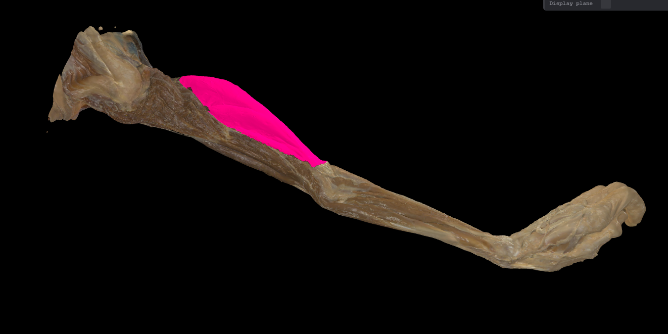 term image