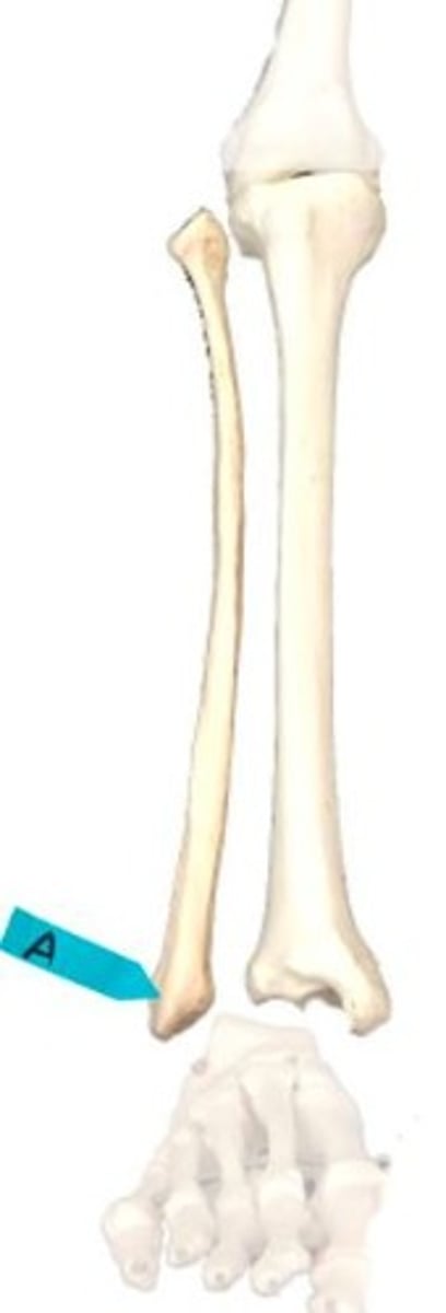 <p>Identify this bone marking.</p>