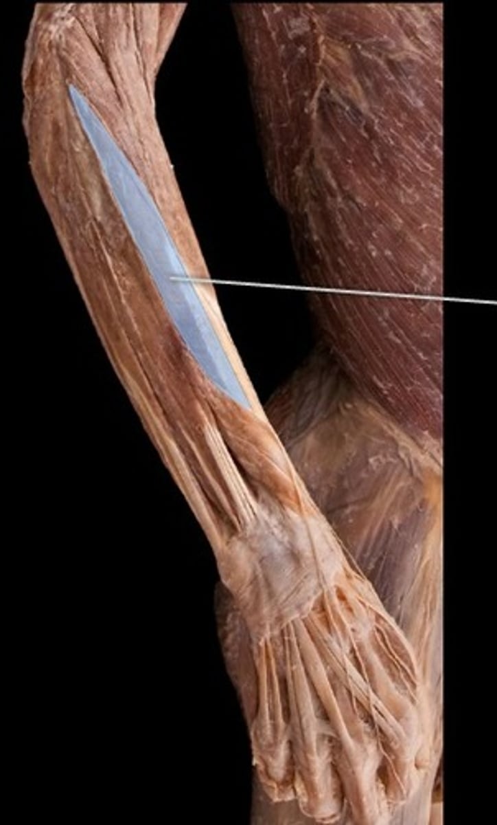 <p>What muscle is this?</p>