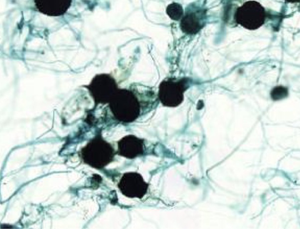 <p>Identify: Fungi</p>