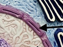 <p>What is the double membrane (envelope) around the nucleus?</p>