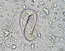 <p>List the egg TYPE for the nematode egg shown.</p>