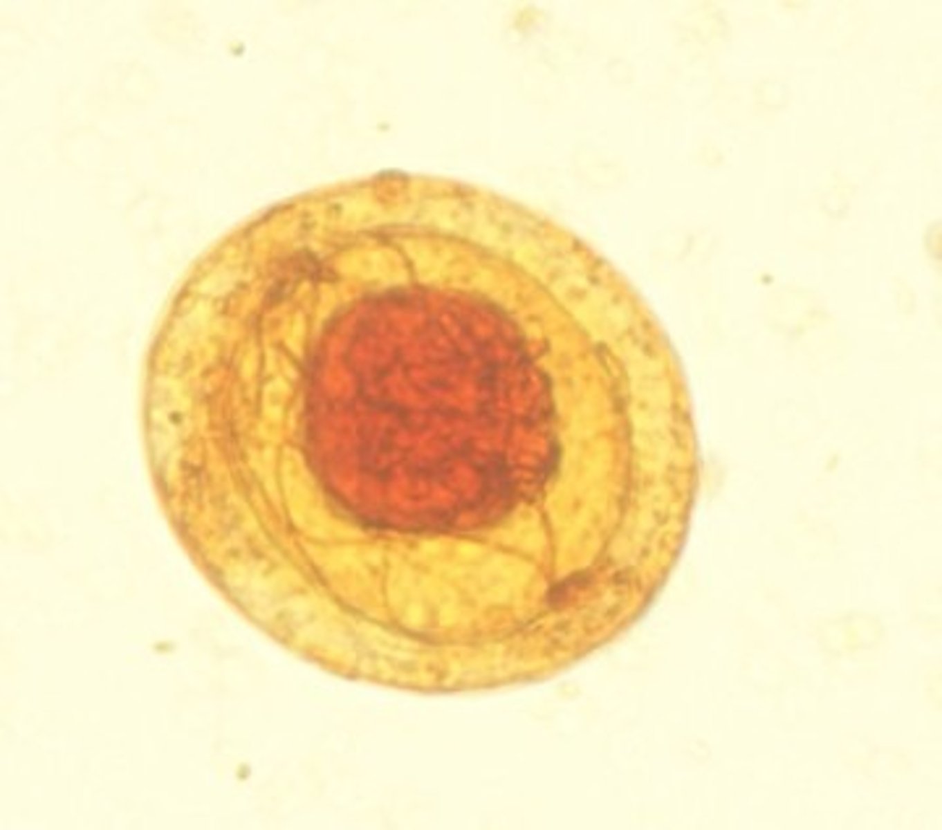 <p>Identify the parasite</p>