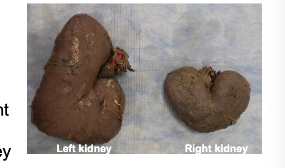 <p>What species do these kidneys belong to? </p>
