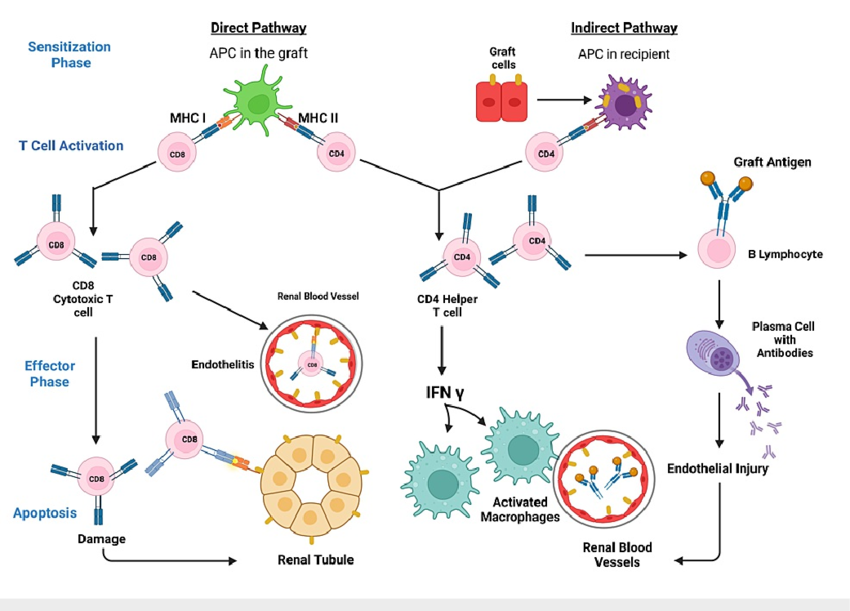 <p><mark data-color="yellow" style="background-color: yellow; color: inherit;">CD4+ T helper cells</mark> release cytokines (IL-2, IFN-γ, TNF) to increase immune activity and HLA expression</p><p><mark data-color="green" style="background-color: green; color: inherit;">CD8⁺ cytotoxic T cells </mark>destroy donor cells presenting the alloantigen (HLA Class I molecules).</p><p><mark data-color="blue" style="background-color: blue; color: inherit;">Alloreactive B cells</mark> produce alloantibodies to bind donor antigens in response to IFN-γ(humoral response: complement-mediated lysis or opsonisation)</p><p></p>