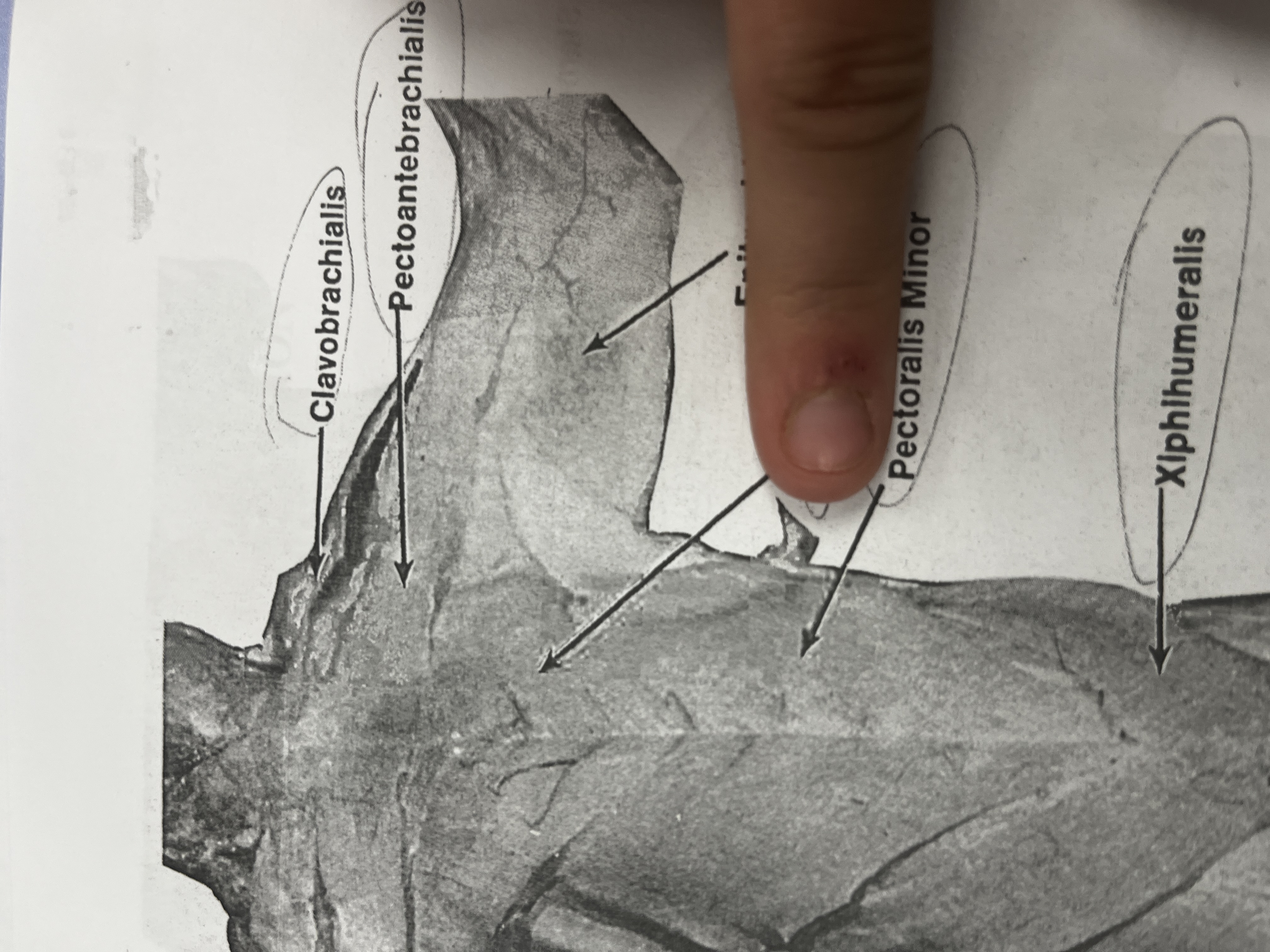 <p>A large muscle in the chest that helps with arm movement.</p>