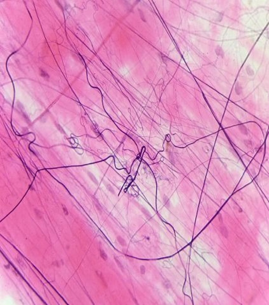 <p>Identify the tissue.</p>