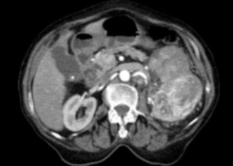 <p><span style="color: rgb(63, 135, 80)">CT Kidneys </span><span style="color: #000000">scan 2 </span></p>