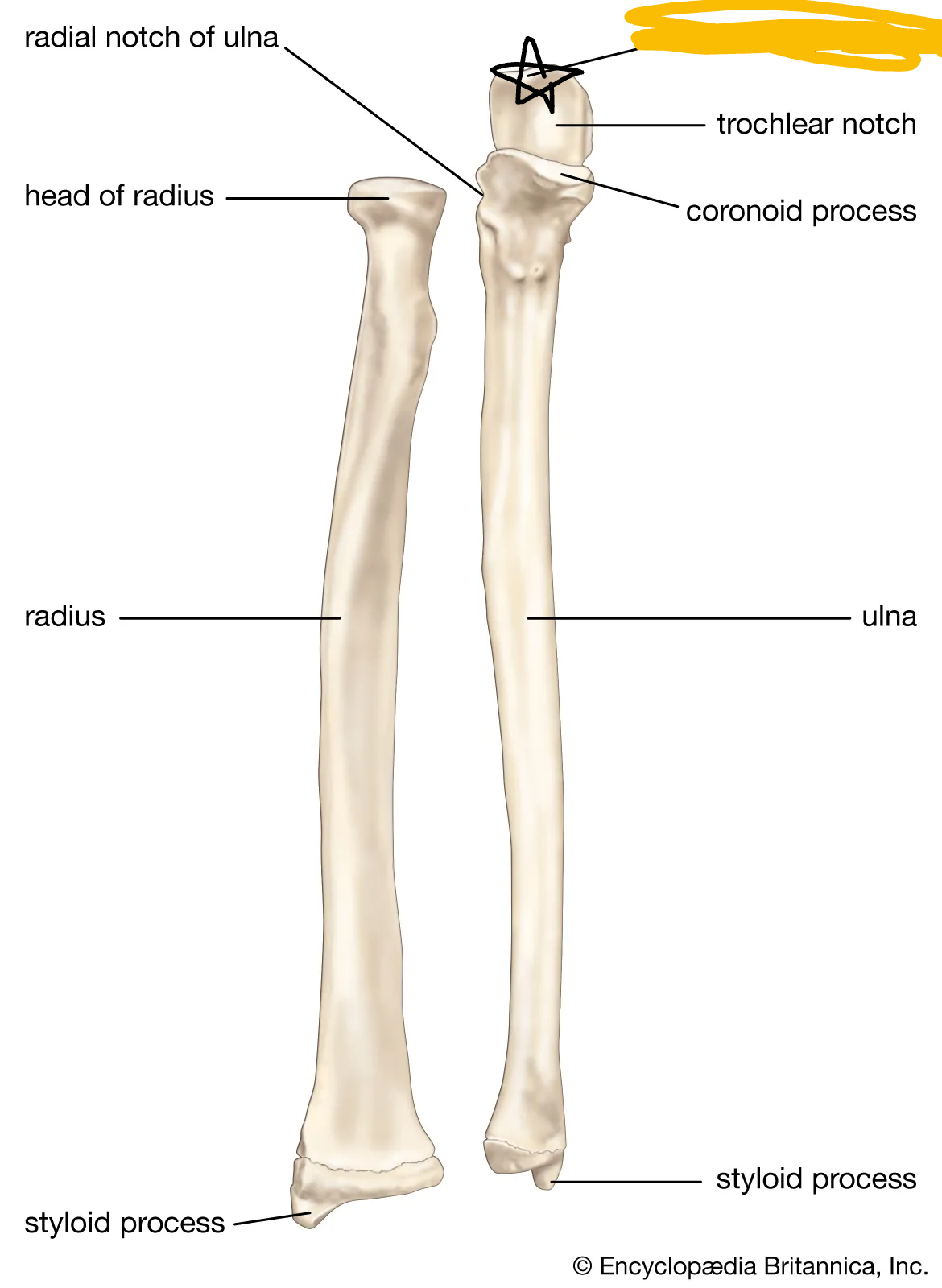 <p>process of ulna on posterior side and proximal side (anterior view right hand picture)</p>