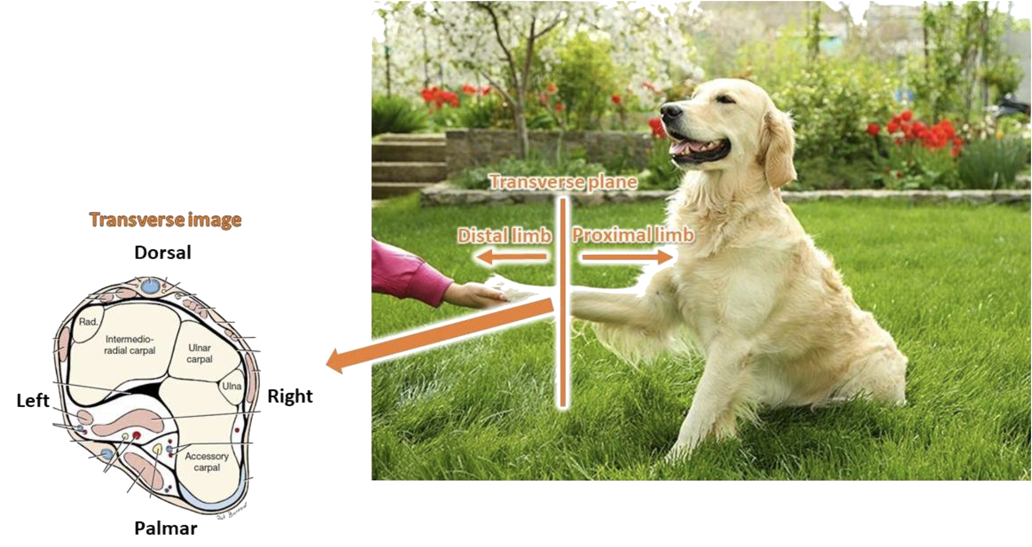 <p>a plane that divides a limb into dorsal and palmar (or plantar) parts</p>