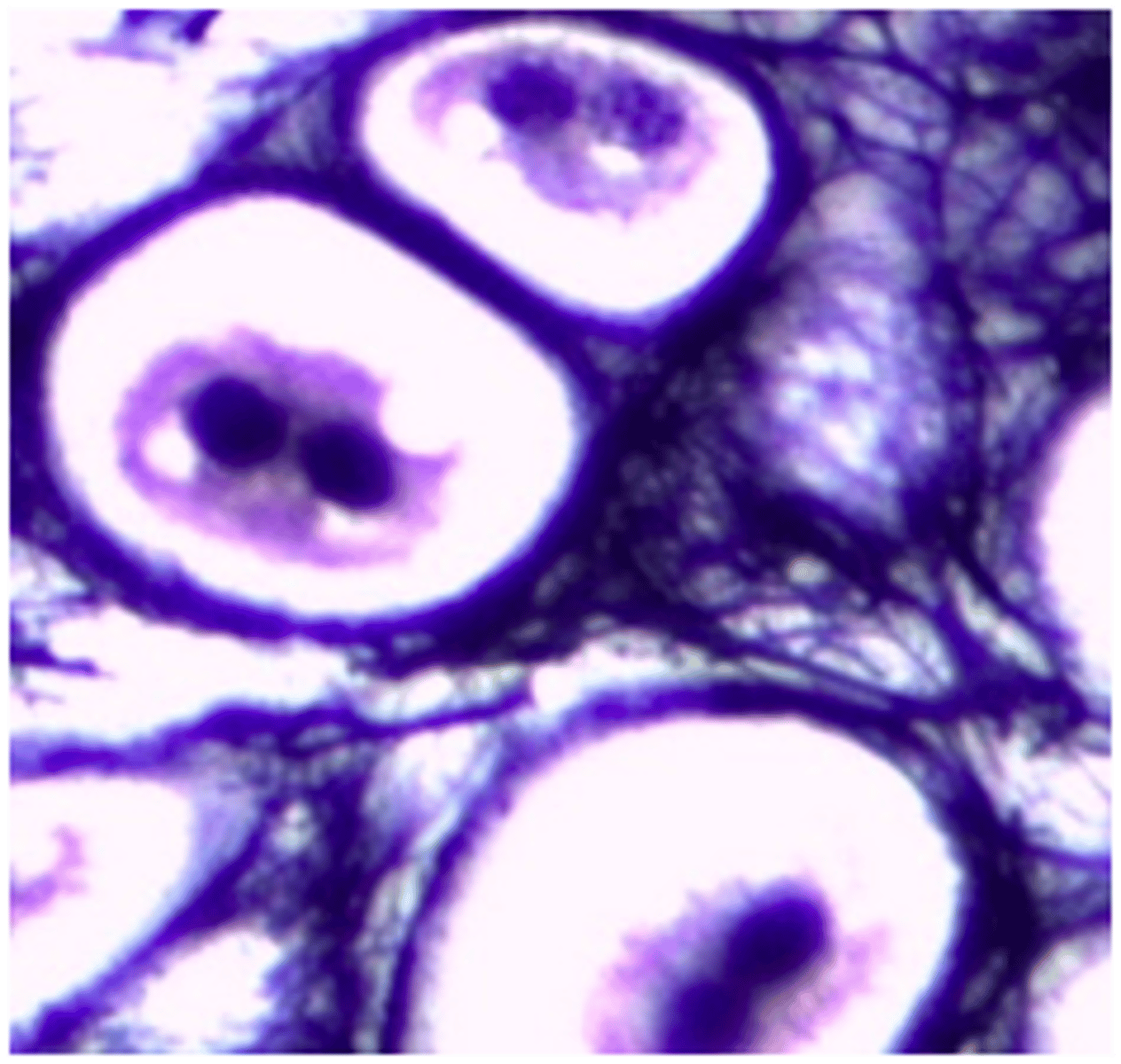 <p>identify the cartilage:</p>