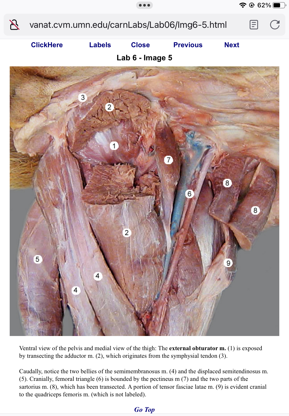 <p>Femoral triangle</p>