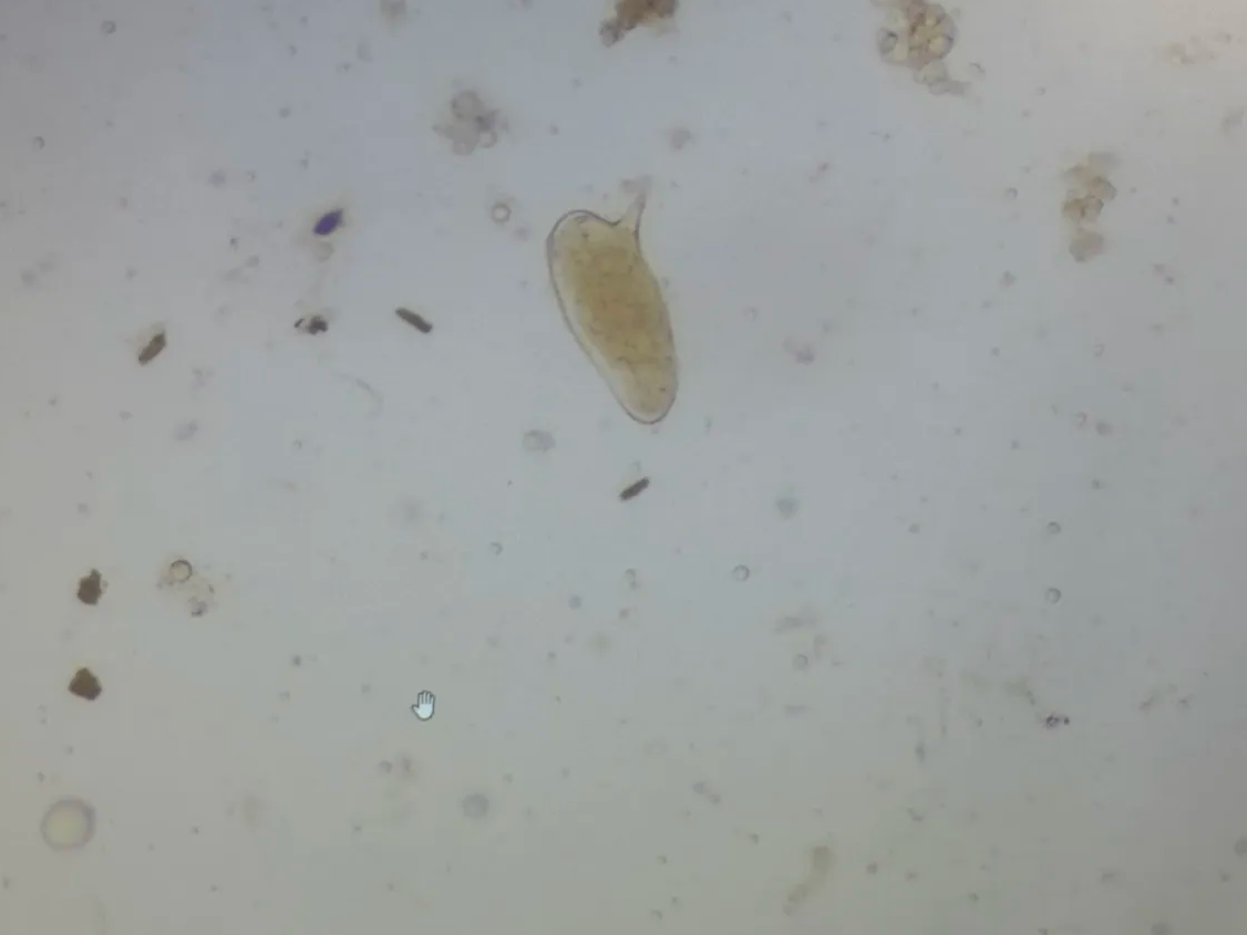 <p>from human stool</p>