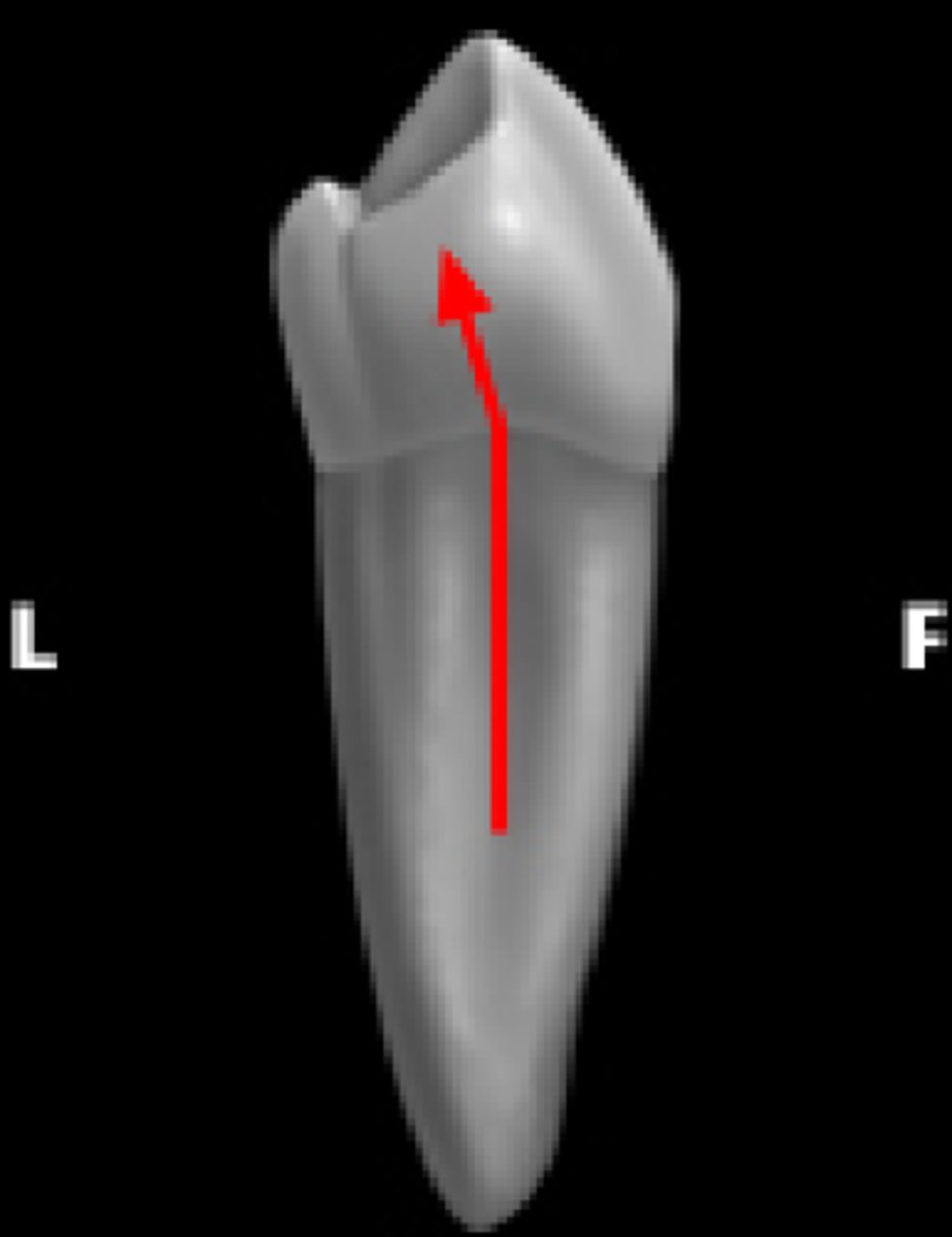<p>crown is tilted lingually compared to long axis of roots</p><p>all lower teeth have this</p><p>important to acheive class 1 (normal) occlusion of oral cavity (upper teeth overlapping lower)</p>