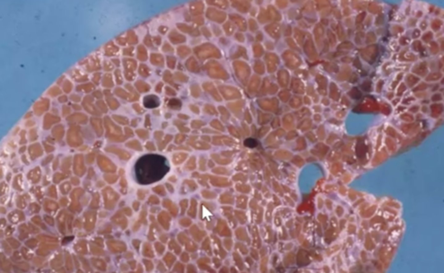 <p>What has caused this gross appearance ?</p>