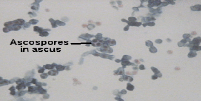 <p>Ascomycetes: This is showing <em>Saccharomyces</em> asci with?</p>