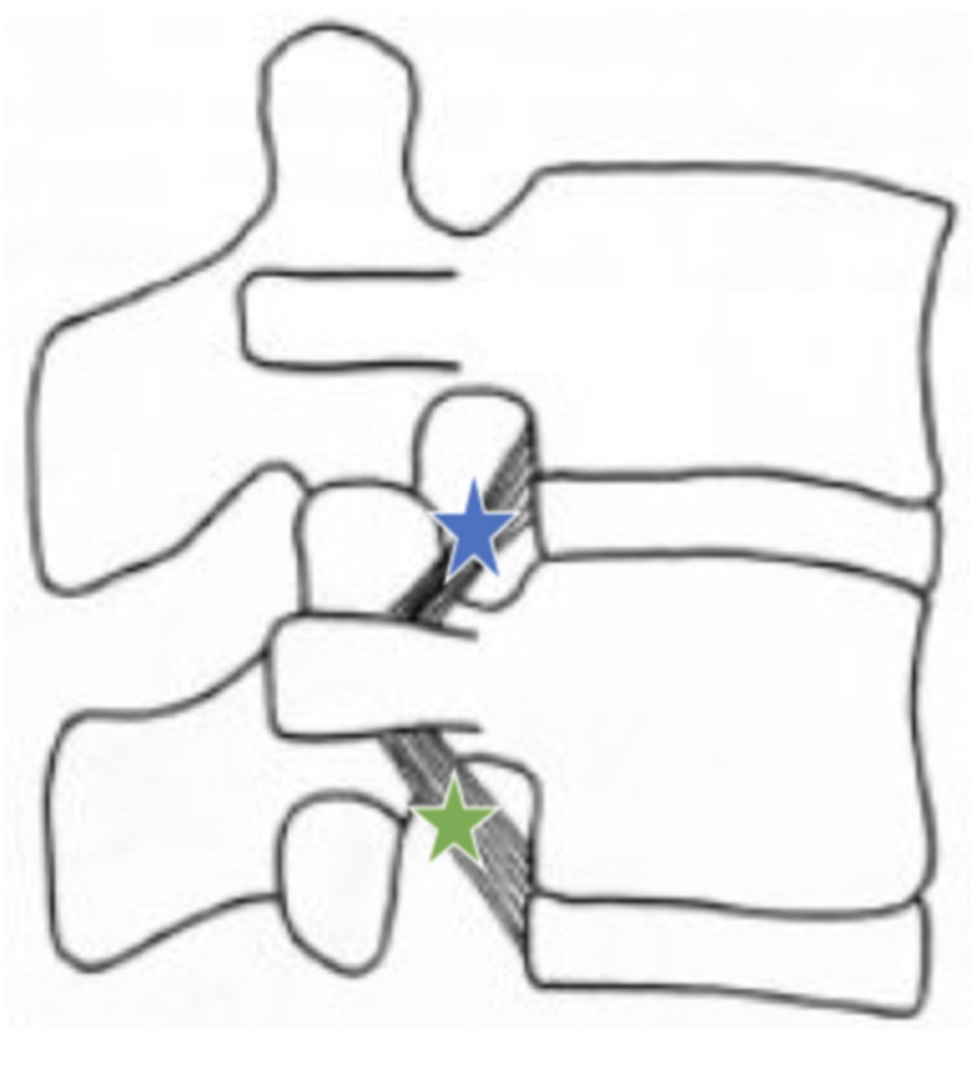 <p>inferior corporotransverse ligament (green star in image)</p>