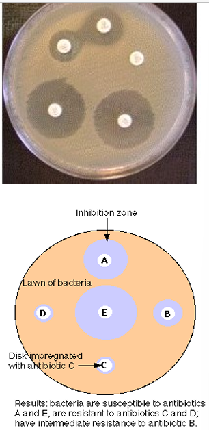 <ol><li><p>inoculate surface of agar plate with test organism</p></li><li><p>apply cellulose discs with standard amount of antibiotic on an agar plate</p></li><li><p>antibiotic diffuses into agar and zone sizes reflect susceptibility or resistance</p></li><li><p>easy to do, cheap, test 4-6 agents at one time</p></li><li><p>not quantitative, only semi quantitative at best</p></li><li><p>many different standard methods e.g. BSAC, Stokes, CLSI</p></li></ol><p></p>