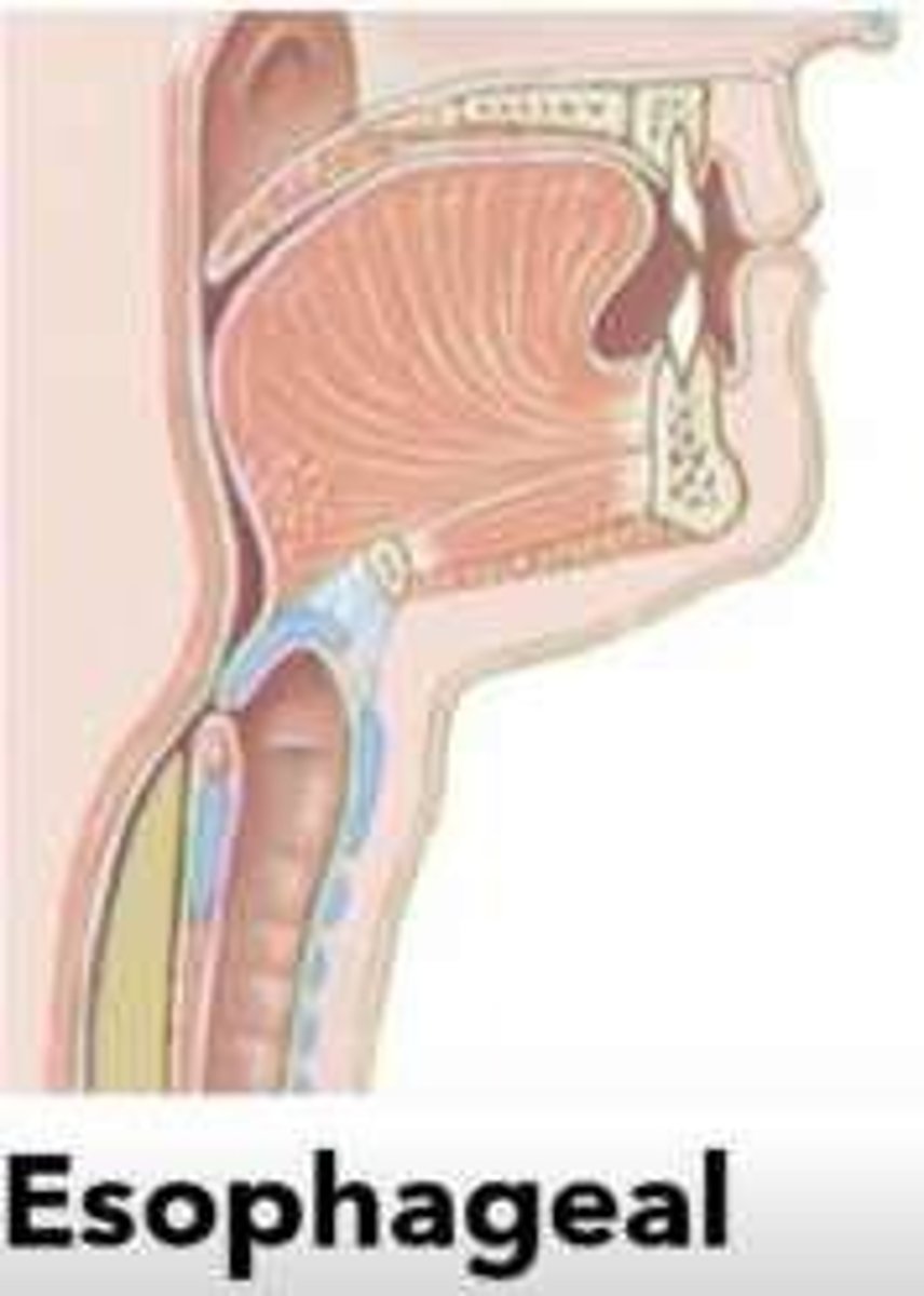 <p>To relax and allow the bolus to enter the esophagus.</p>