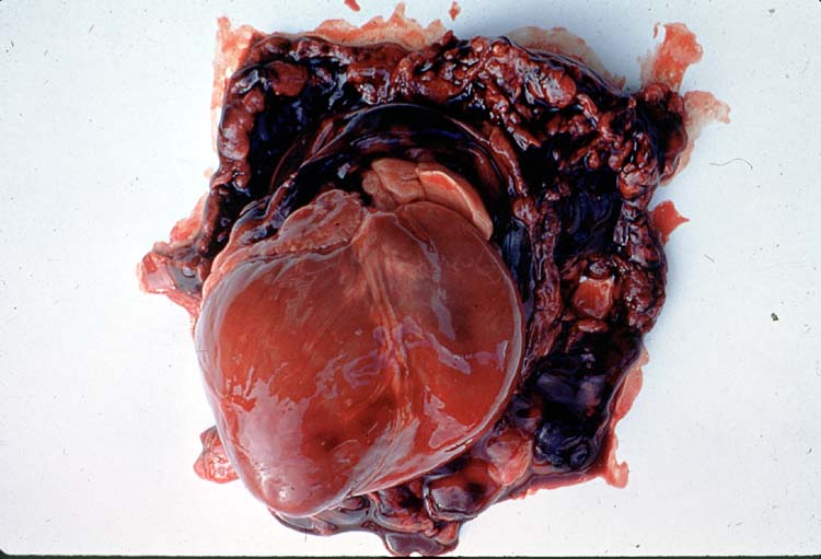 <p>Identify the lesion.</p>