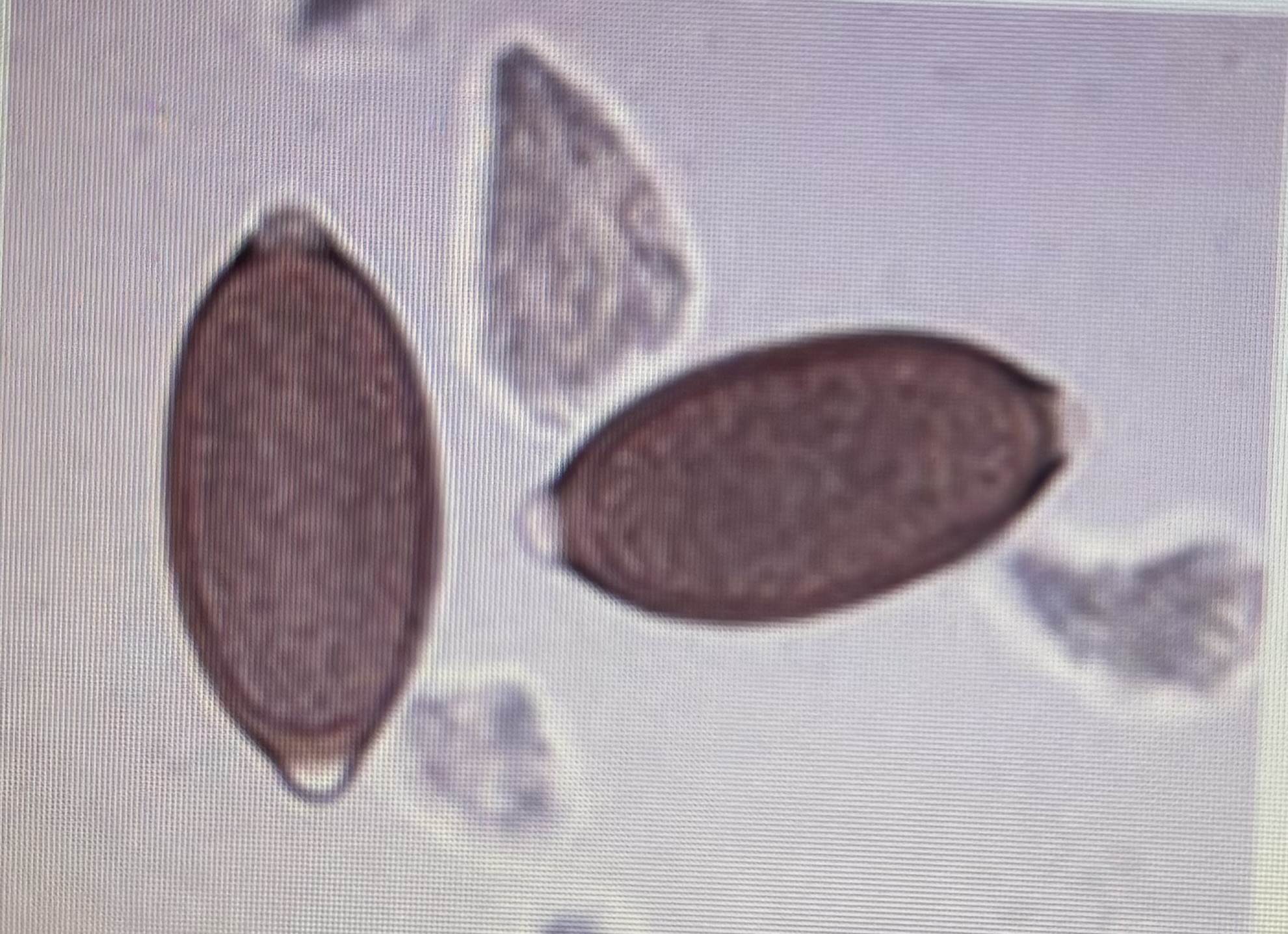 <p>Trichurid</p><p>Host species: dog</p><p>Size: 72-90 um x 32-40 um</p><p>Prepatent period: 90 days</p><p>Transmission: ingestion</p><p>No zoonotic potential</p>