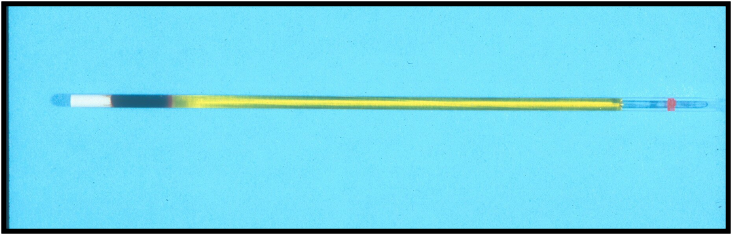 <p>Lipemia/Icterus/Hemolysis</p>