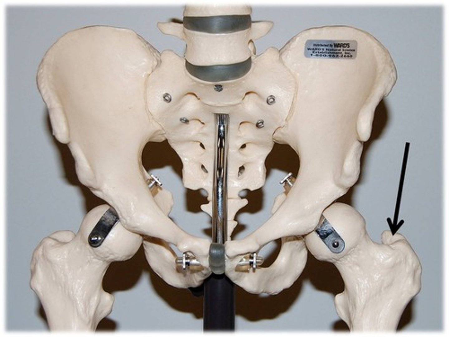 <p>Name this specific part of the femur.</p>