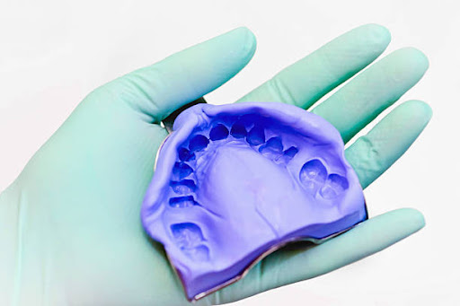 <p>Negative molds of the mouth that capture the shape of teeth and tissues.</p>