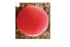 <p>During osmosis what is the cell experiencing&nbsp;</p>