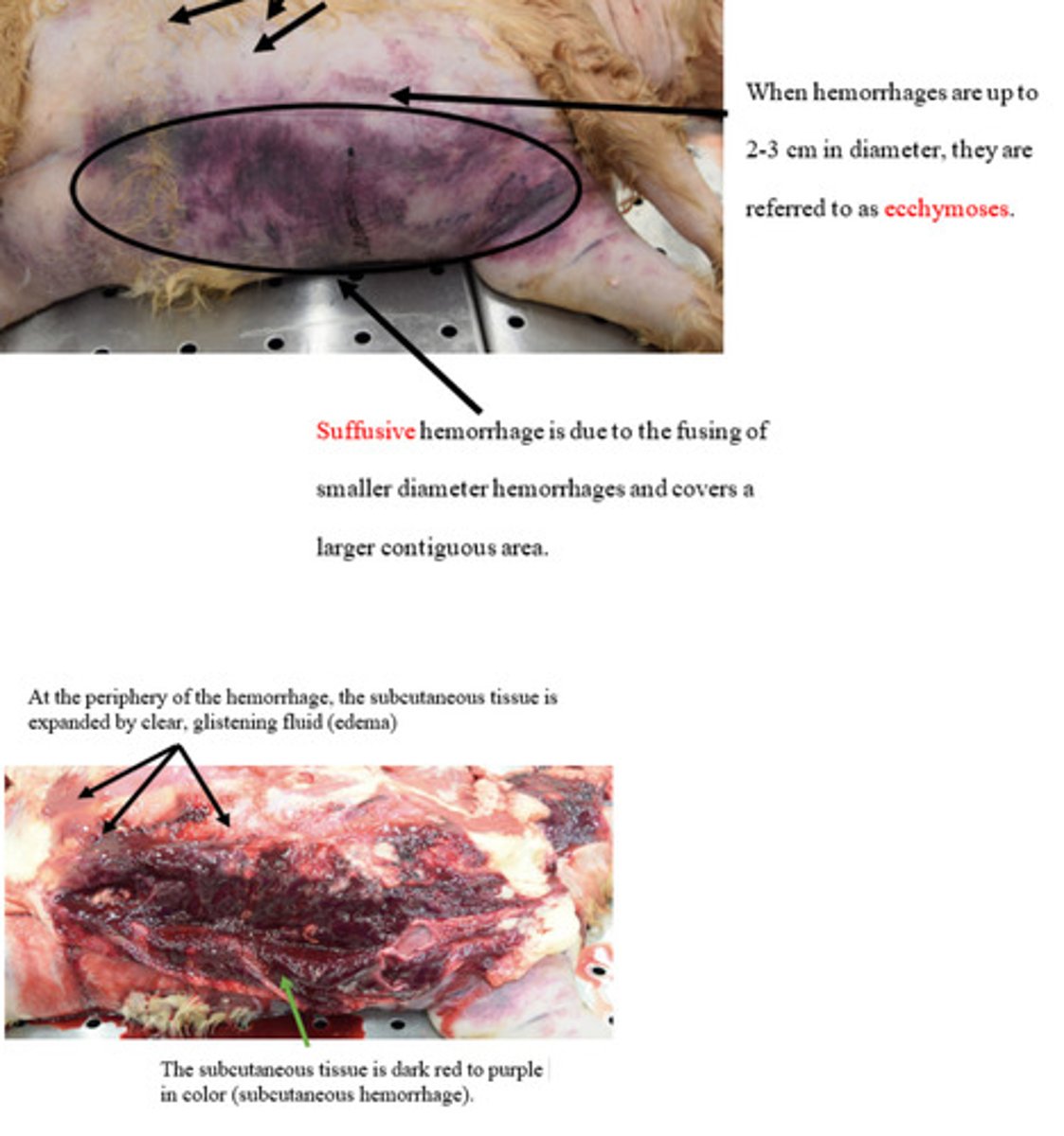 <p>What are 3 patters of hemmorrhage we have learned?</p>