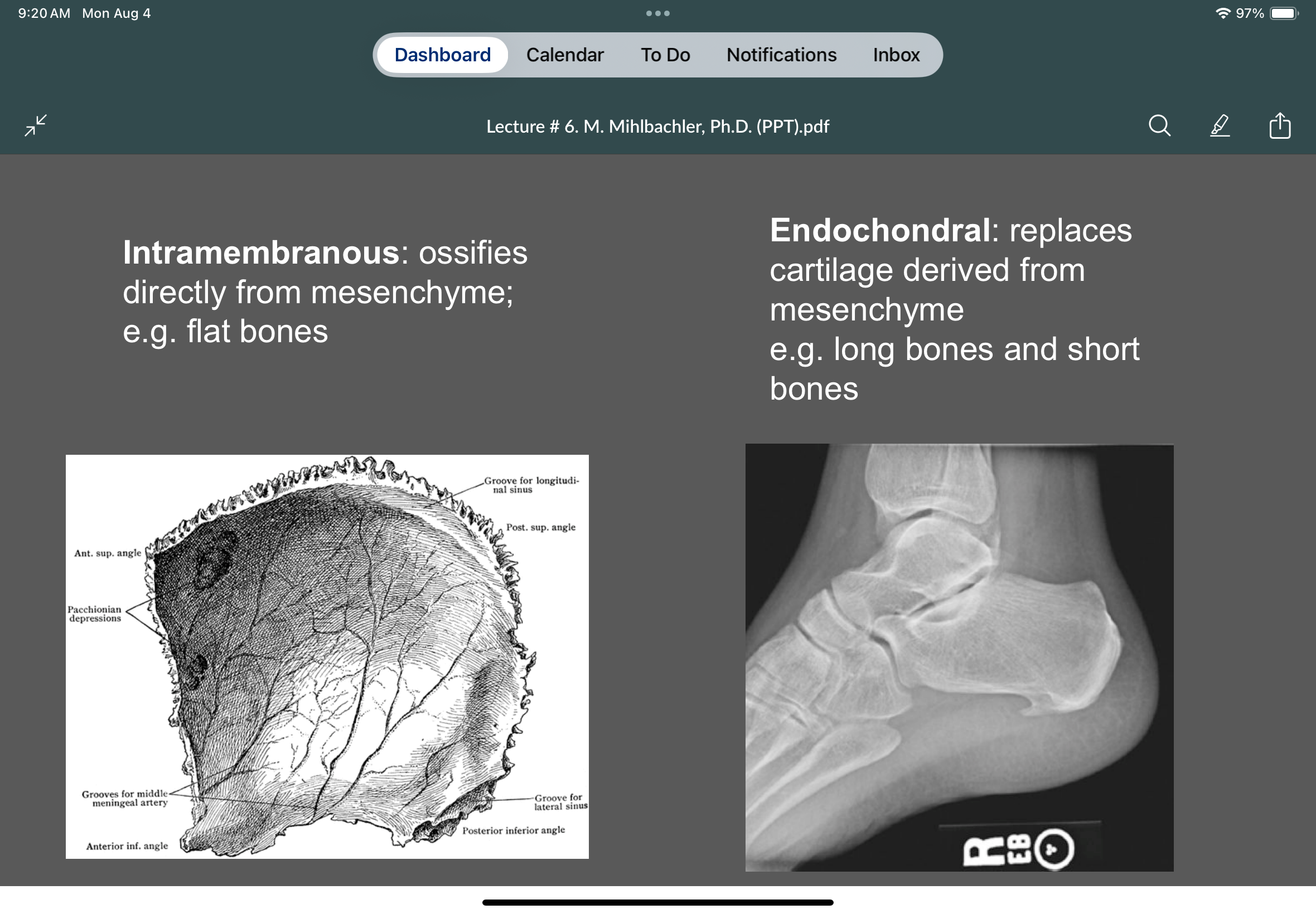 <p>Develops directly from mesenchyme</p>