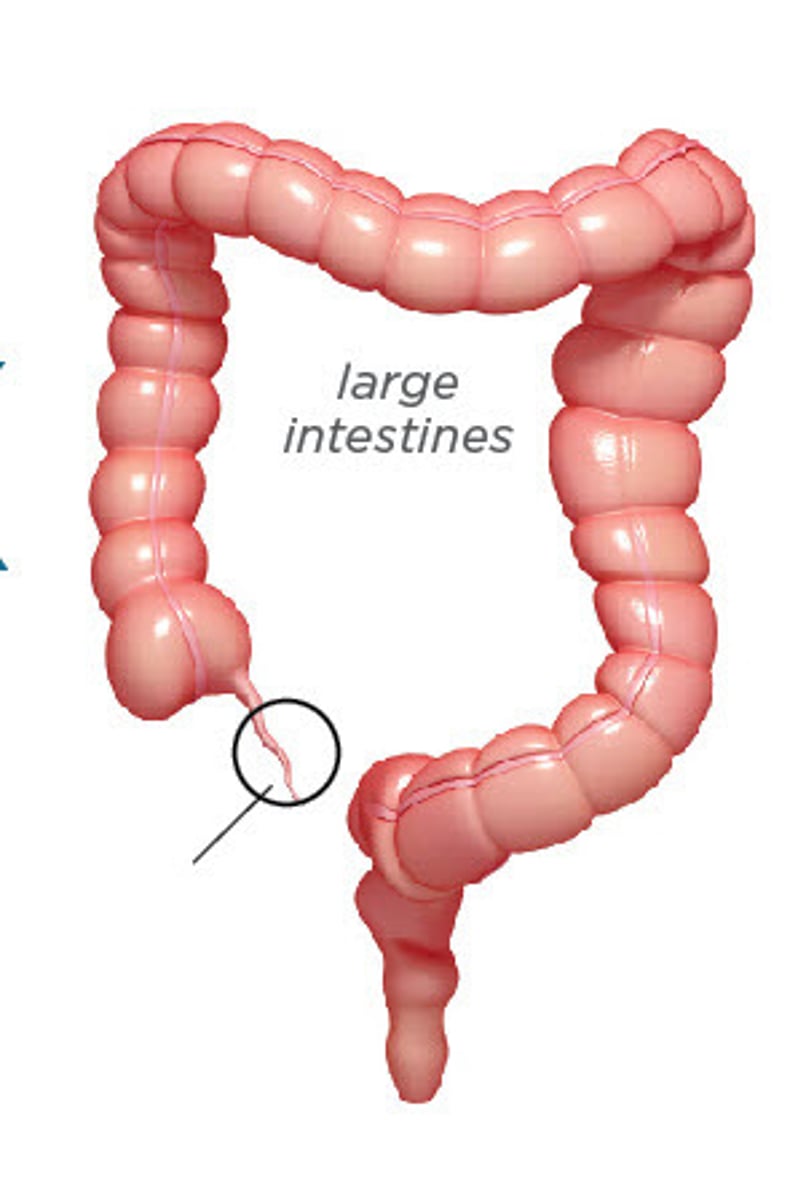 <p>(Looks different on lab model)</p>