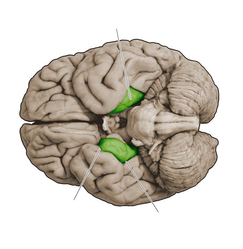 <p>Rhinal Sulcus- Sulcus in the Para hippocampal gyrus on the ventral-medial margin of the anterior temporal lobe; separates a prominent medial bulge from the rest of the Para hippocampal gyrus</p>