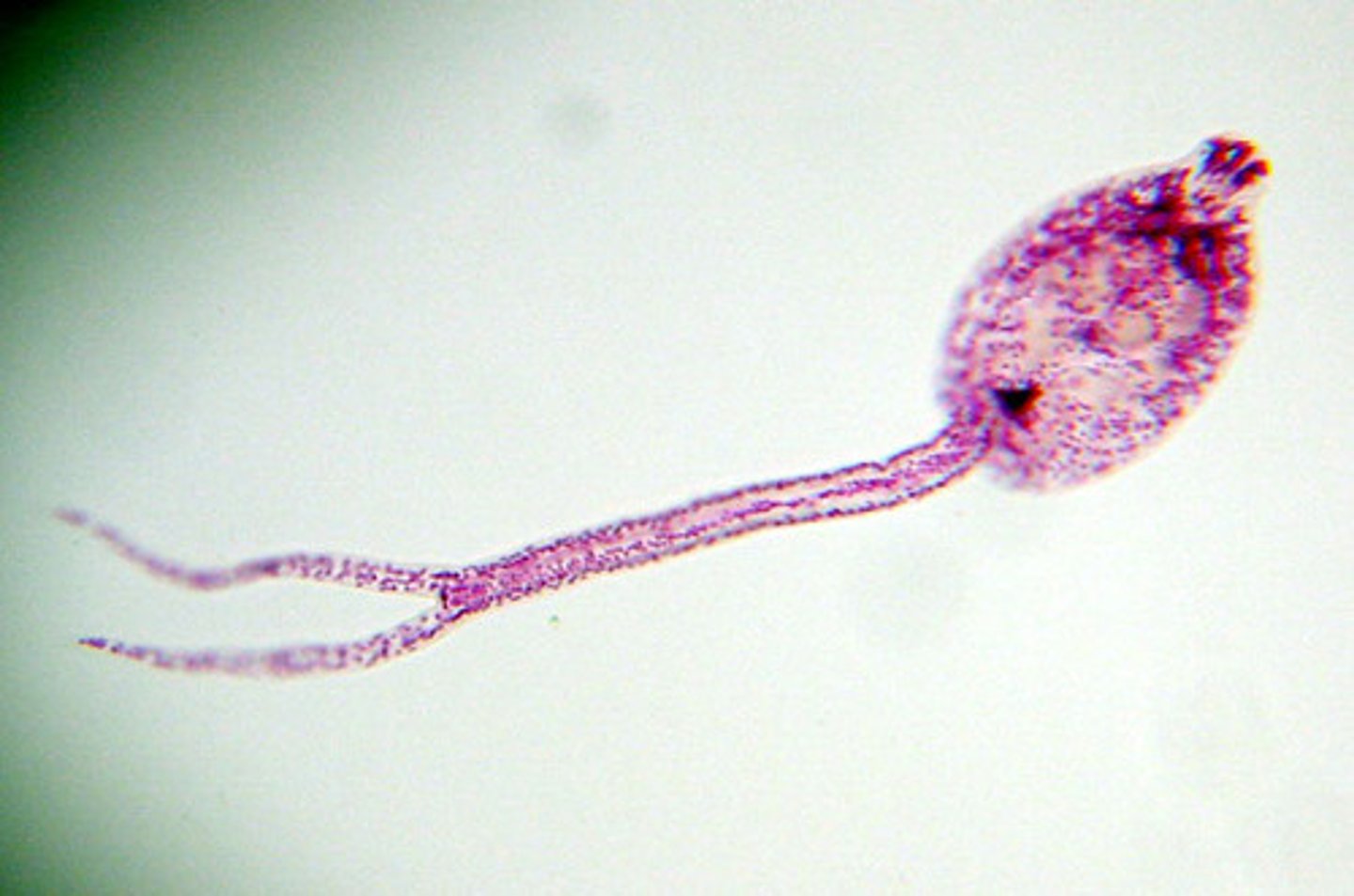 <p>- Larvae with the ability to bore through human skin</p>