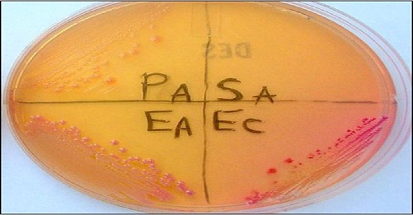 <p>DES</p><p>Selective:</p><p>Differential:</p><p>Dyes/Reagents:</p>