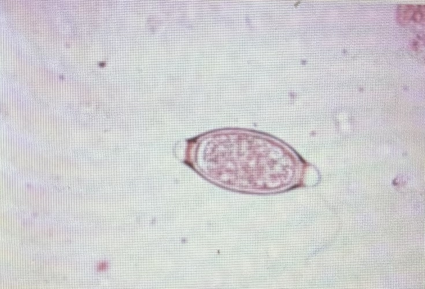 <p>Swine whip worm </p><p>Size 50-56 um x 21-25 um </p>