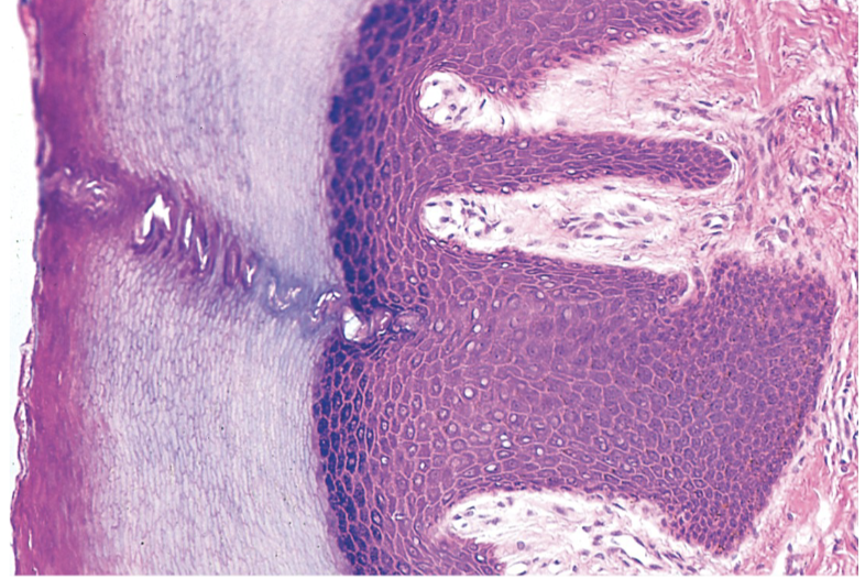 <p>Stratified Squamous Epithelium Keratinized</p>