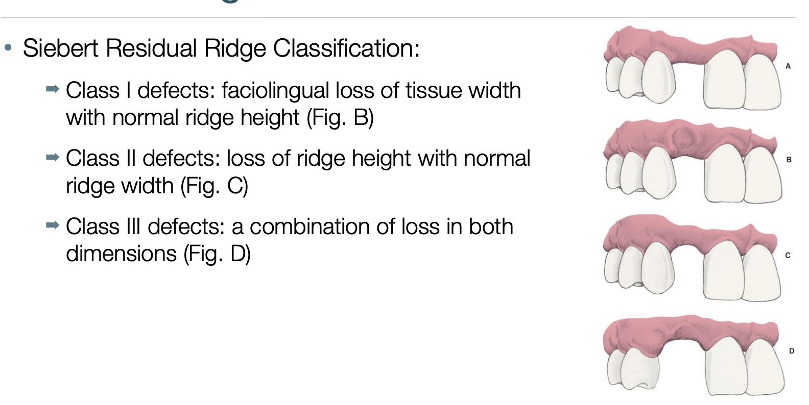 <p>siebert residual ridge classification- I, II, III </p>