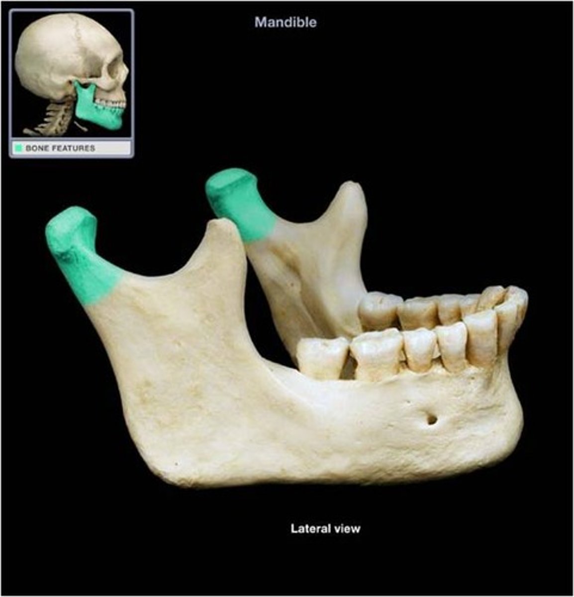 <p>inserts into mandibular fossa of temporal bone to form the TMJ</p>