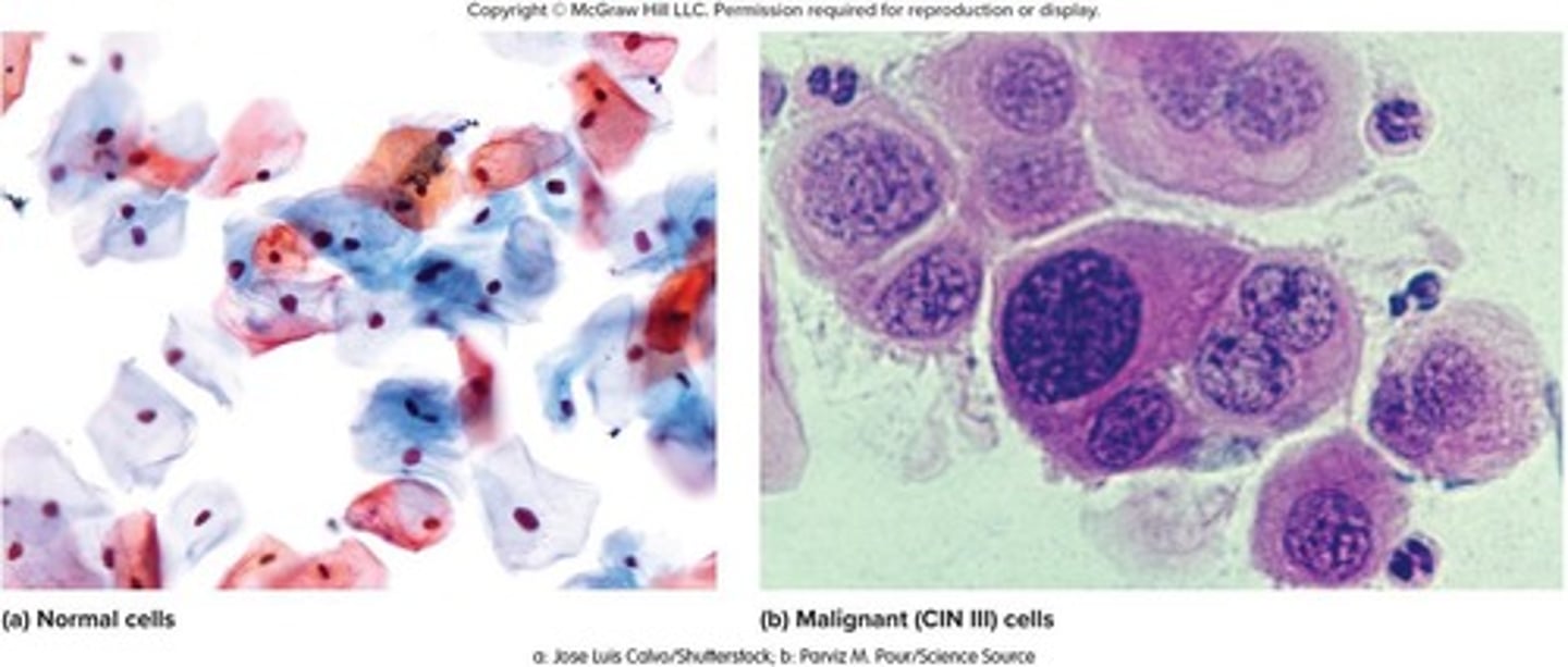 <p>A test for early detection of cervical cancer, involving the removal and microscopic examination of loose cells from the cervix and vagina.</p>