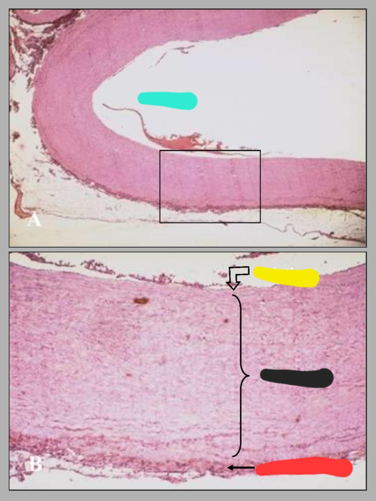 <p>Name of this slide? State the parts of the colored parts.</p>