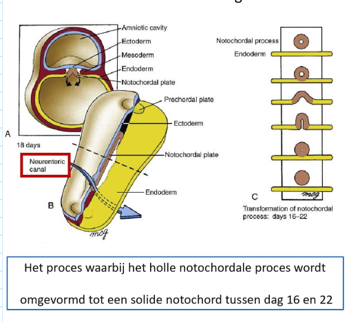 <ul><li><p>holle notochordale proces naar solide notochord → tussen dag 16 &amp; 22</p><ul><li><p>eerst fuseert ventrale wand van notochordale proces met endoderm → 2 lagen breken af, waardoor afgeplatte notochordale plaat achterblijft</p></li><li><p>proces begint aan caudale einde van notochordale proces (B) &amp; vordert craniaal (stippellijn markeert niveau van A)</p></li></ul></li></ul><p>→ open neuraal kanaal wordt tijdelijk gecreëerd tussen amniotische holte &amp; dooierzakholte (neurenterisch kanaal)</p><p>→ reeks gebeurtenissen waardoor notochordale proces notochordale plaat wordt &amp; vervolgens het notochord (C)</p><p></p>