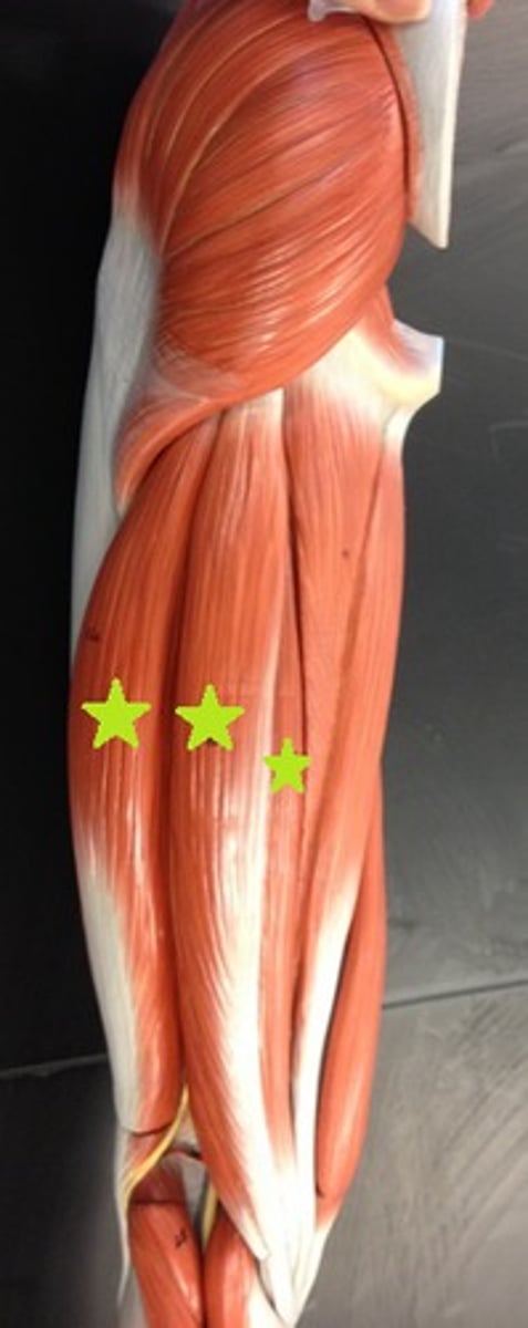 <p>A group of muscles that flex the knee, including biceps femoris, semitendinosus, and semimembranosus.</p>