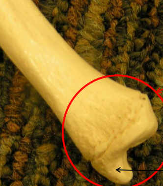 <p>What is the red circle? </p>