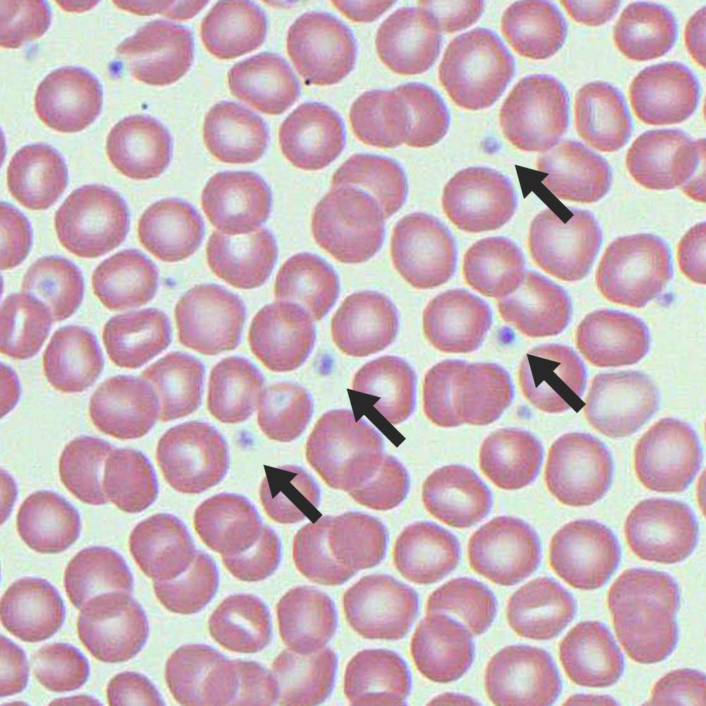Platelets