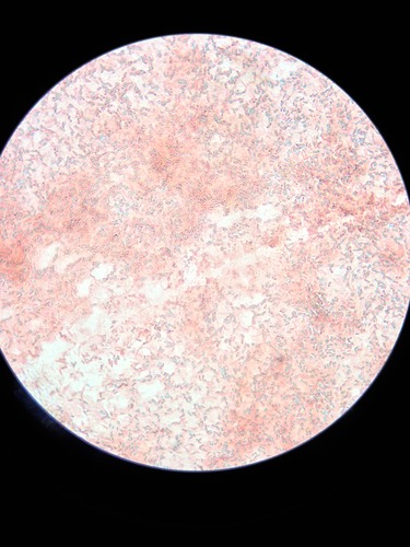 Identify the bacterial structures here that stain green with malachite green