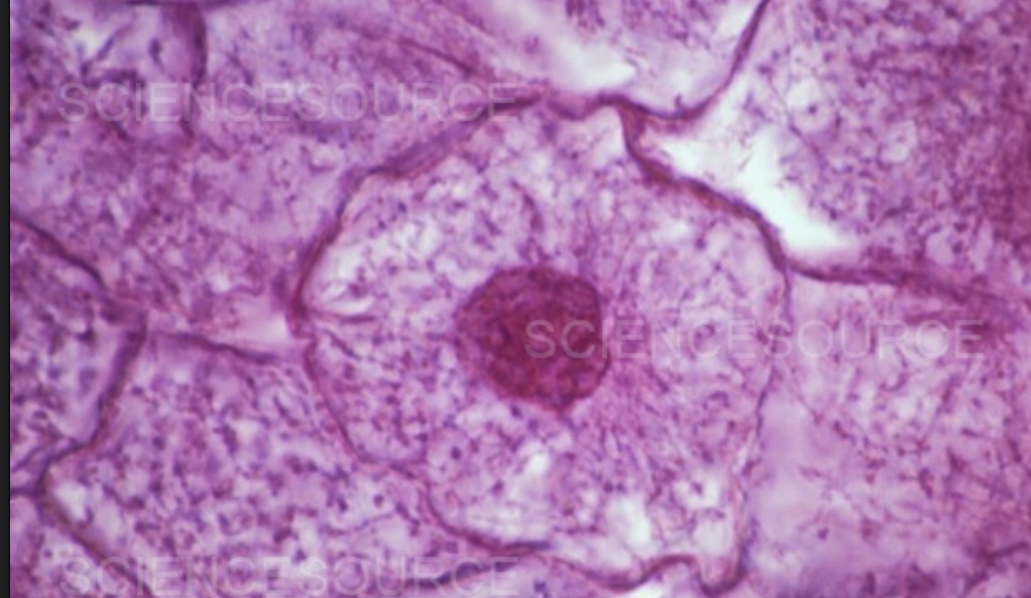 <p>Late interphase</p>