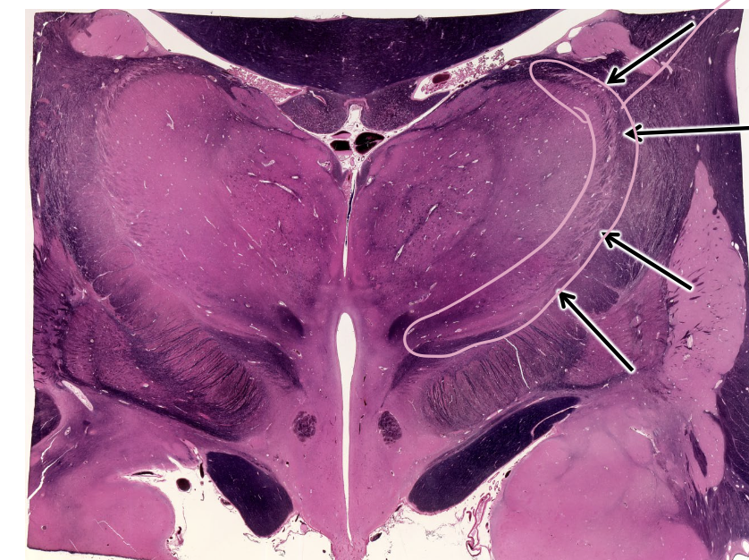 <p>what is this structure outlined in pink?</p>